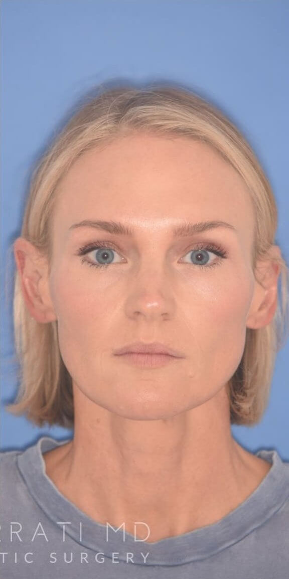 A woman with short blonde hair and blue eyes looks directly at the camera against a plain blue background. She wears a blue top.