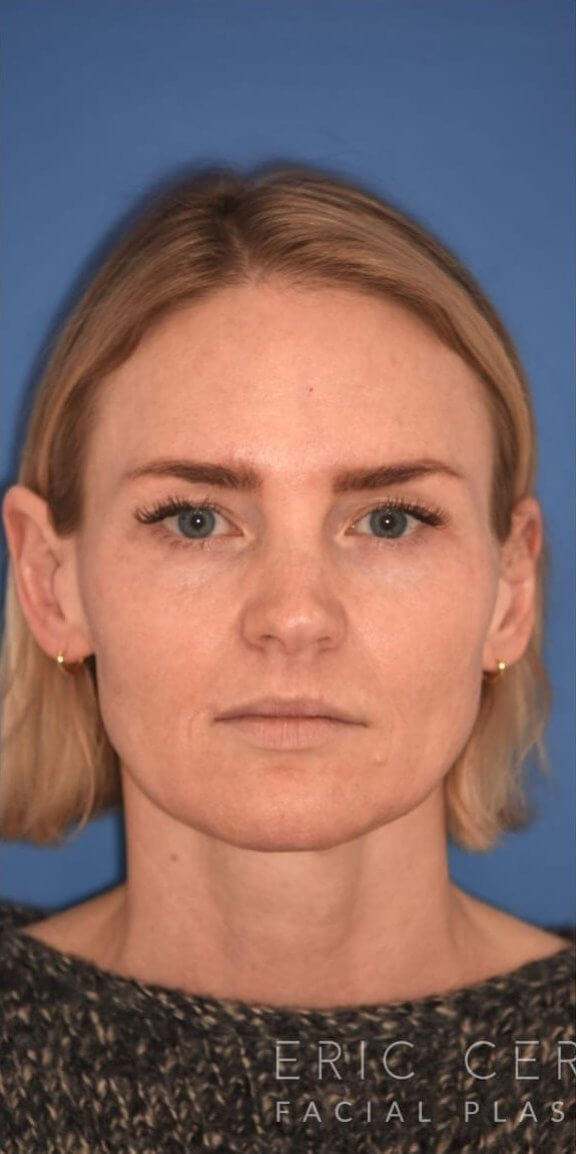 A woman with short blonde hair and blue eyes looks straight at the camera against a blue background. "ERIC GER" and "FACIAL PLA" text is visible at the bottom right corner.