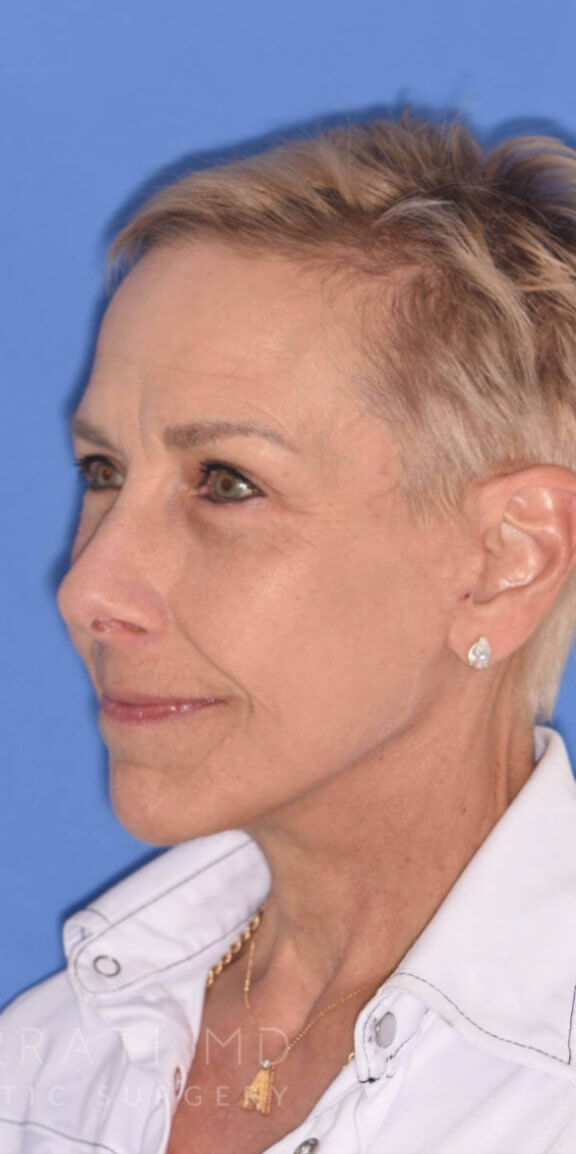 A woman with short blonde hair and light skin, wearing a white collared shirt and a small earring, is seen in partial profile against a blue background.