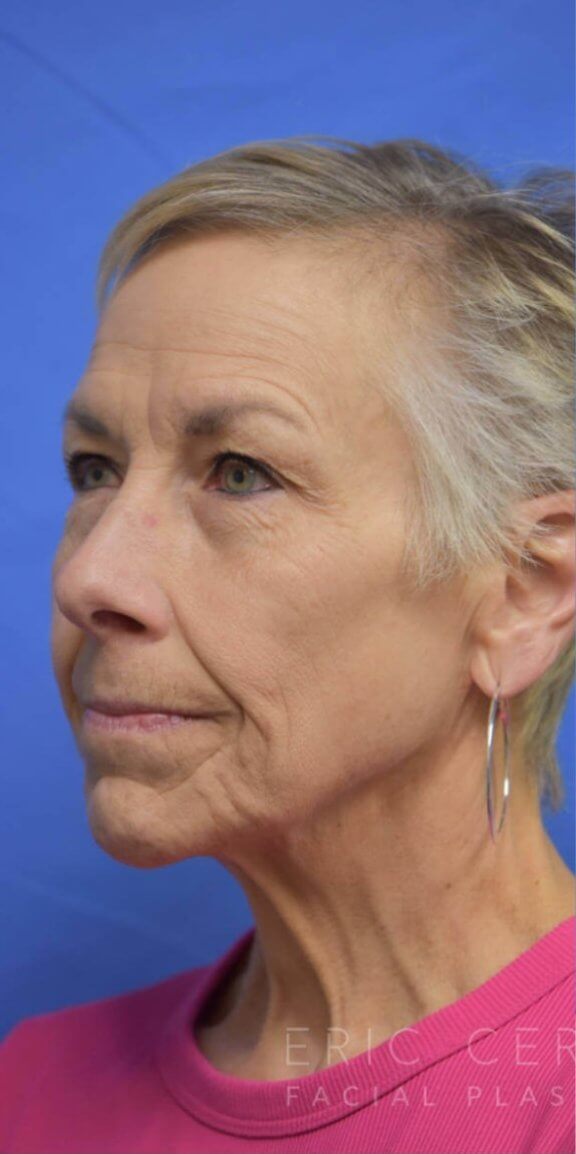 Older woman with short, light hair and hoop earrings wearing a pink top, shown against a solid blue background, facing slightly to the left.