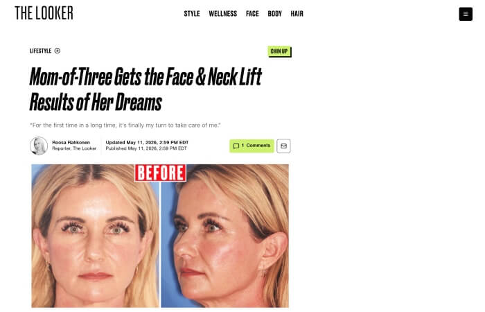 screenshot of article titled: Mom-of-Three Gets the Face & Neck Lift Results of Her Dreams